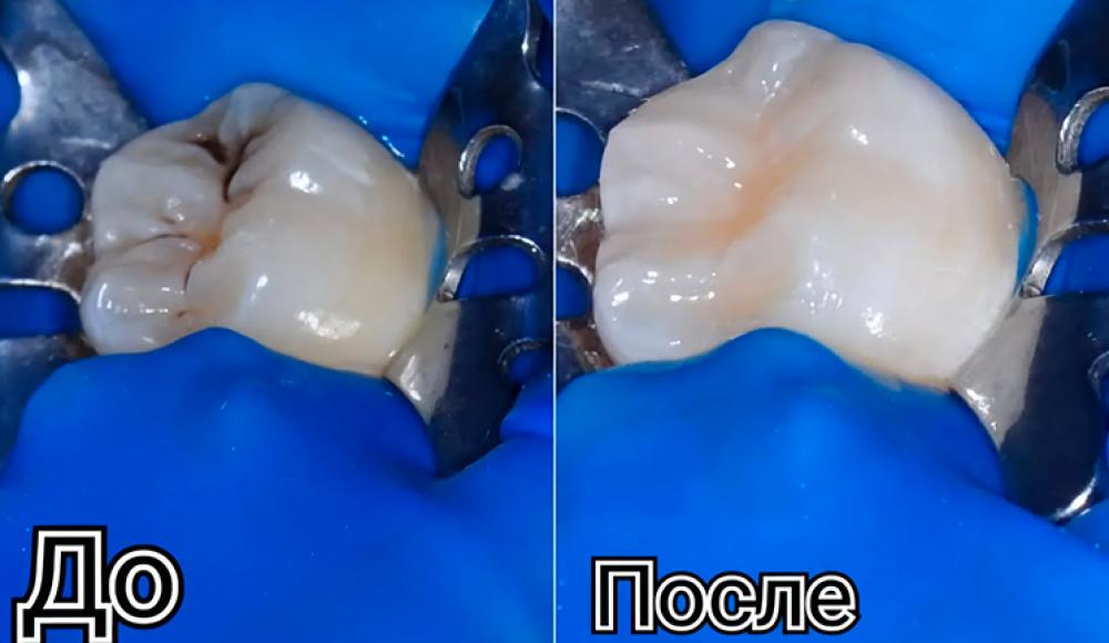SOLEVI DENT стоматология