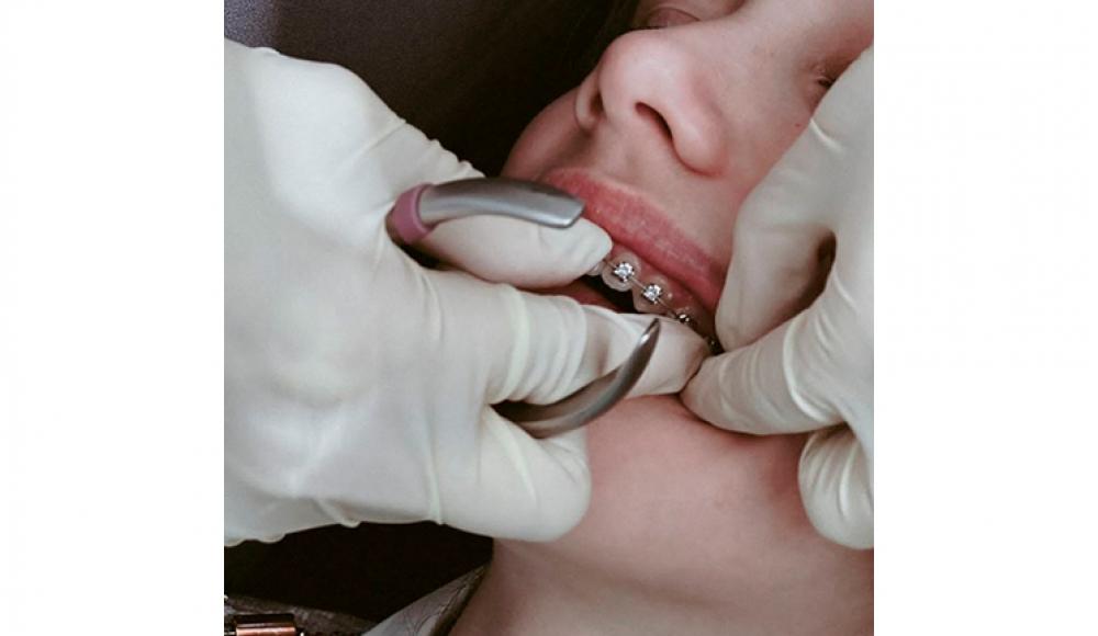 SOLEVI DENT стоматология